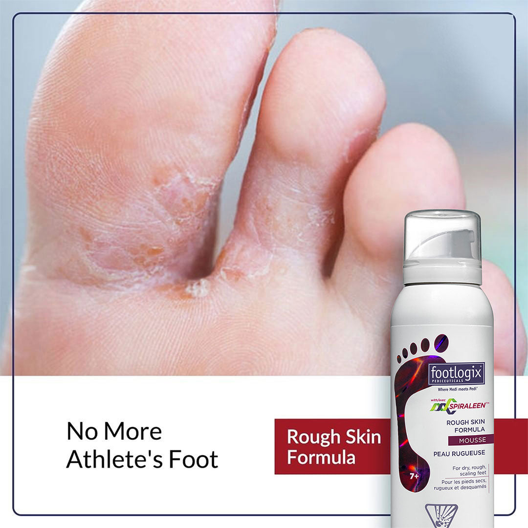 Footlogix Pediceuticals Rough Skin Formula Mousse (125ml)